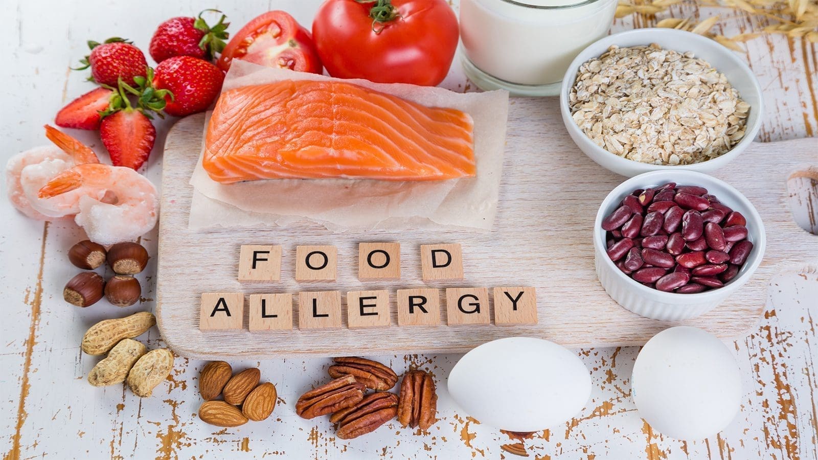 Food Allergy Canada releases guidelines for managing food allergens