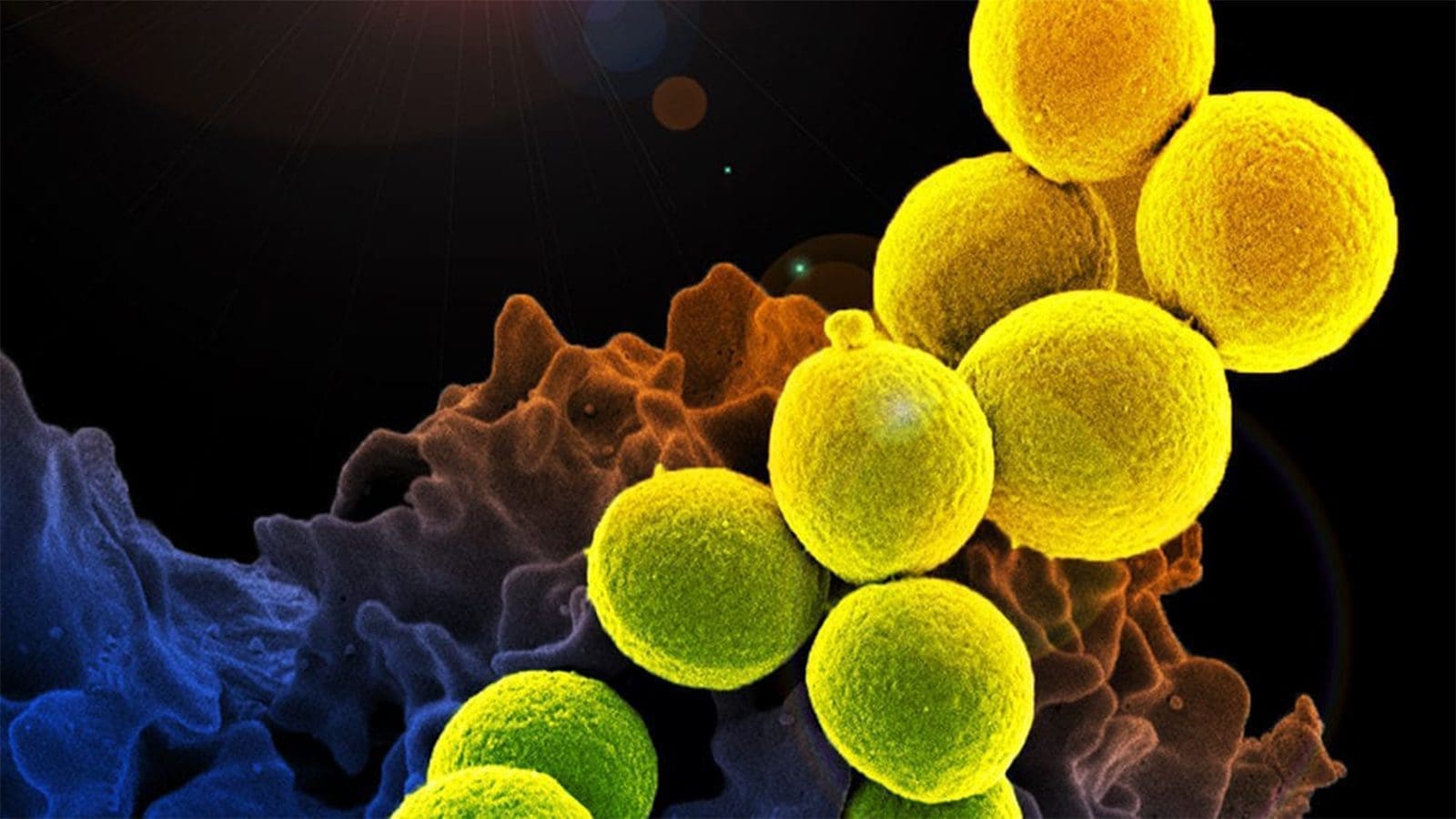 Canada adopts comprehensive plan to combat antimicrobial resistance with One Health Approach